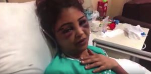Read more about the article Woman Brutally Beaten By Hubby For Her Salary