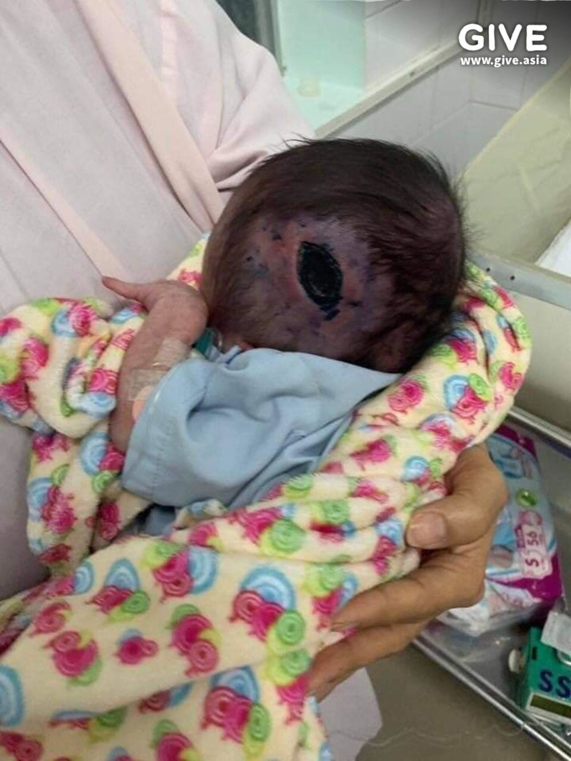 Read more about the article Baby Dumped In Tree Has Head Filled With Maggots