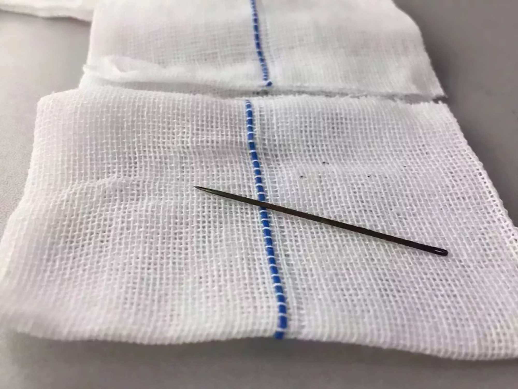 Read more about the article Boy, 11, Loses Rusty Sewing Needle Up Penis