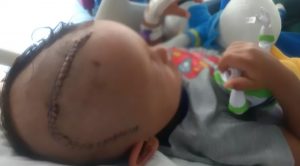 Read more about the article 3yo Left With 100 Stitches After Biker Hits Him And Gran