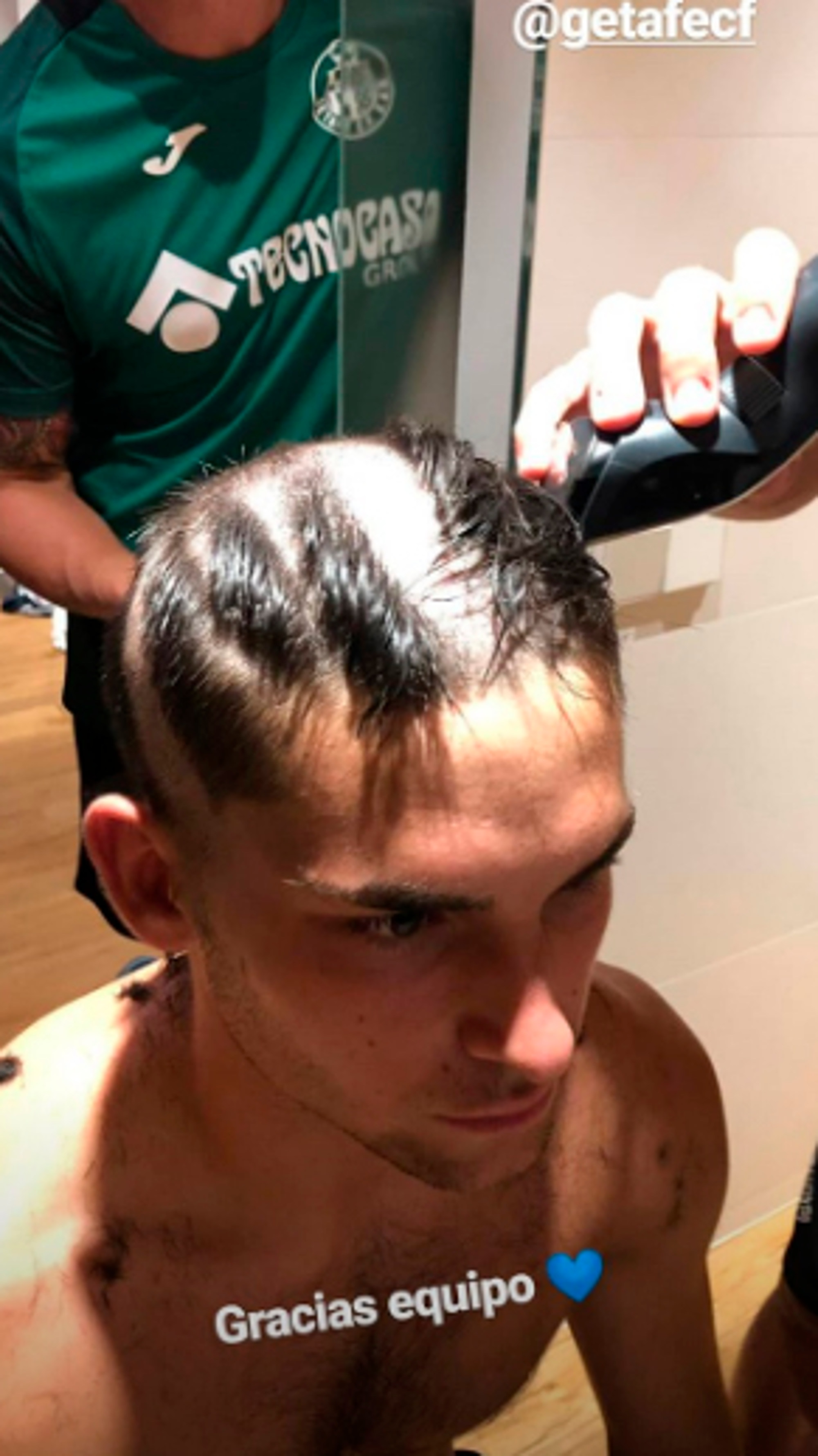 Read more about the article Footballer Left With Huge Patches As Teammates Cut Hair