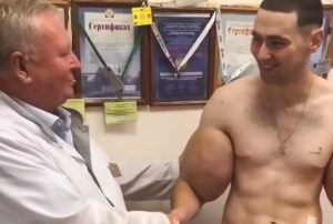 Read more about the article Popeye Bodybuilder Under Knife For Groin Operation