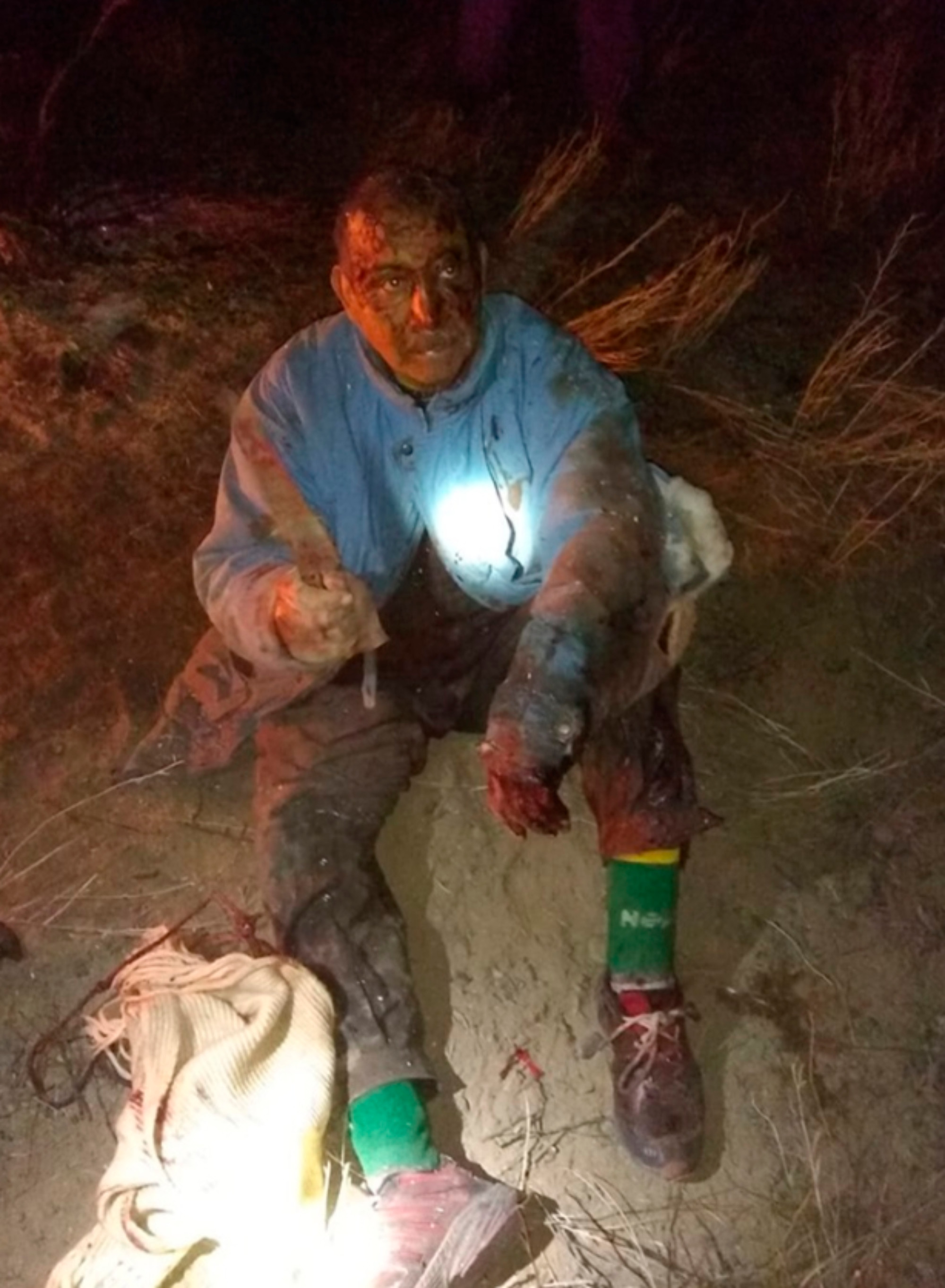 Read more about the article Farmer Survives Fight With Puma That Attacked His Dog