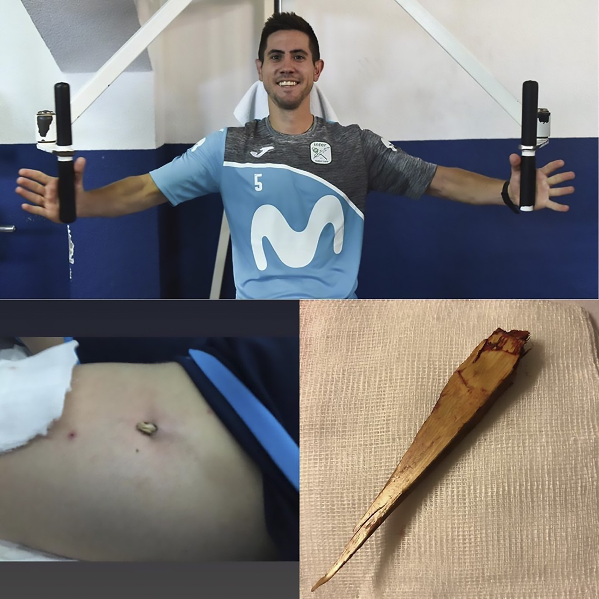 Read more about the article Futsal Player Has 4-Inch Splinter In Leg During Match