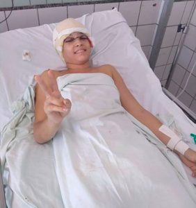 Read more about the article Pretty 19yo Girl Has Scalp Ripped Off In Go-Kart Smash