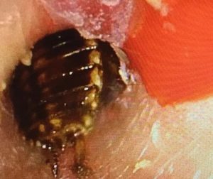 Read more about the article Chewing Cockroach Burrows Into Toddlers Ear
