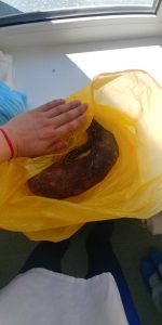 Read more about the article Drs Remove Huge 4.4lb Hairball From Teen Girl Stomach