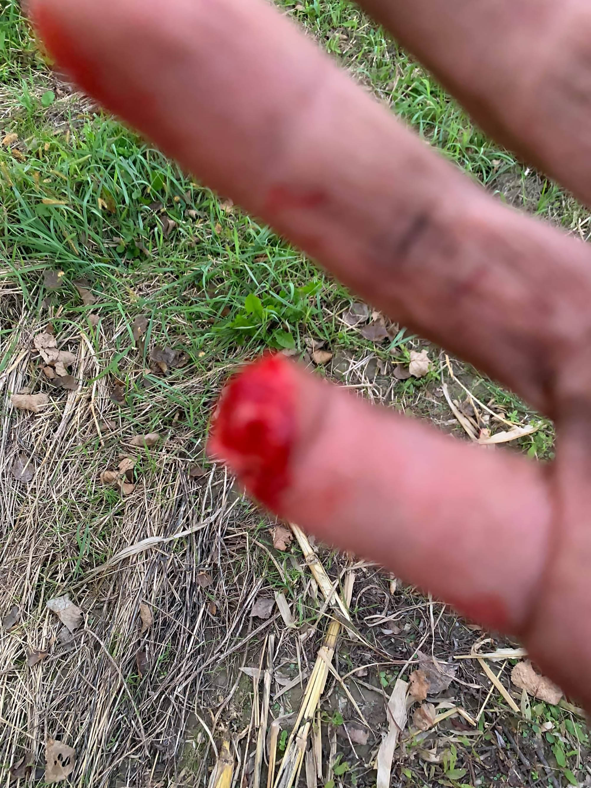 Read more about the article MMA Fighter Has Finger Torn Off In Farming Accident