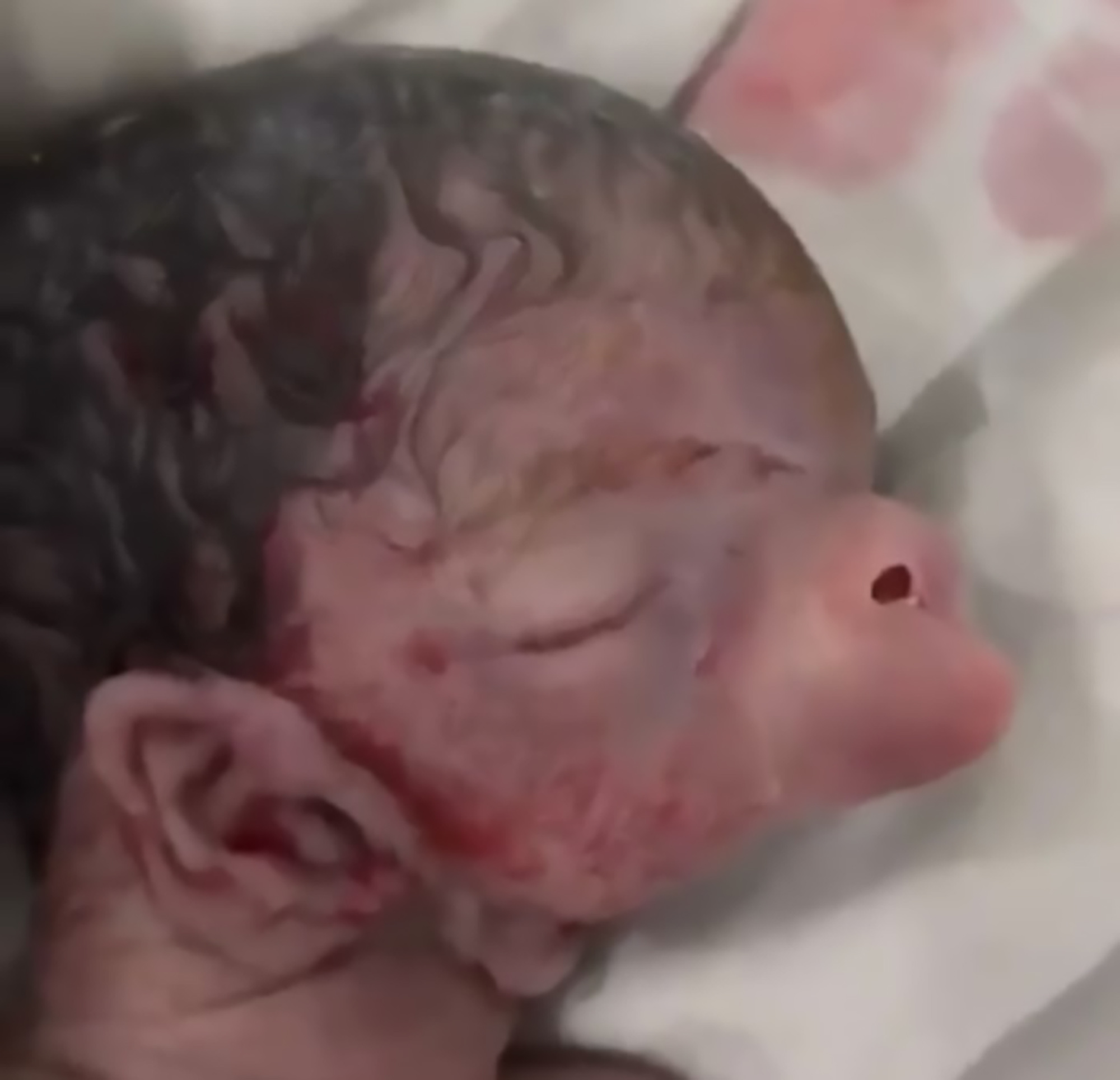 Read more about the article Baby Born With Pigs Snout Nose And Ears On Neck