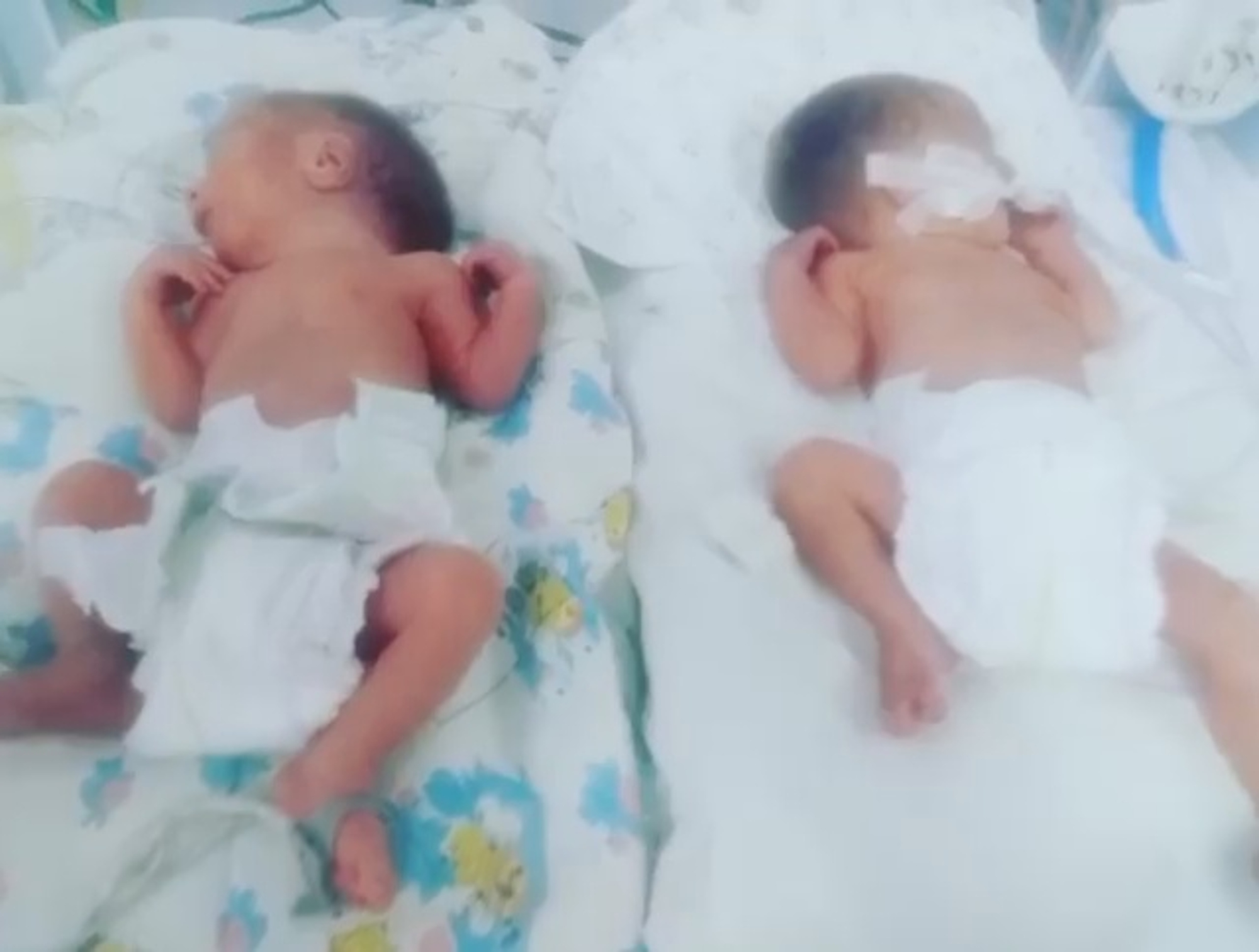 Read more about the article Mum Gives Birth To Premature Twins On 15th Birthday