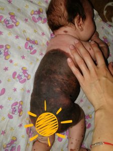 Read more about the article Cruel Priest Refuses To Baptise Cute Tot With Birthmark