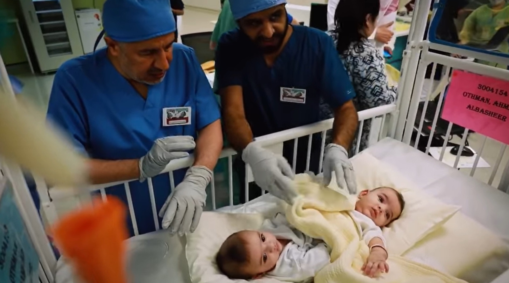Read more about the article Conjoined Twins Separated By 35 Drs In 14-Hour Op