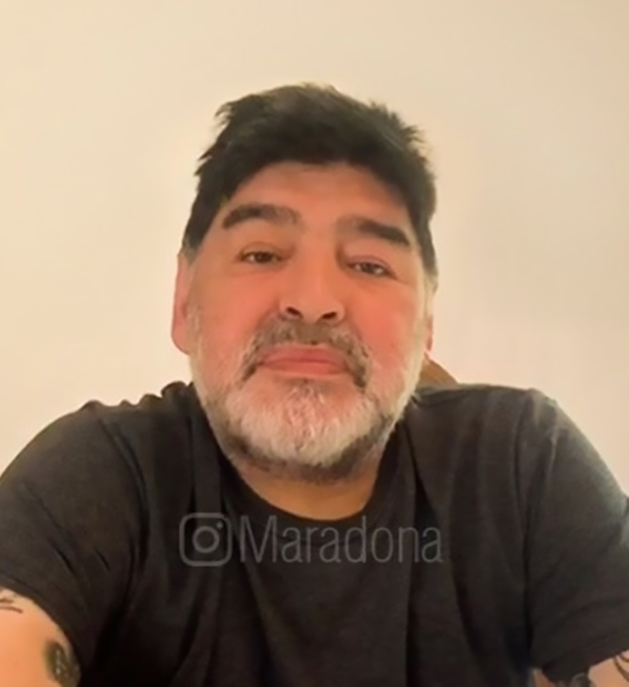 Read more about the article Maradona Saved With Liquid Coming From His Nose