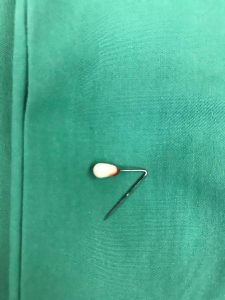 Read more about the article Swallowed Headscarf Pin Removed From Womans Lung