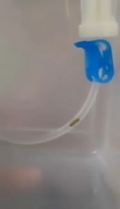Read more about the article Angry Dad Finds Insect In Sons IV Drip Tube At Hospital