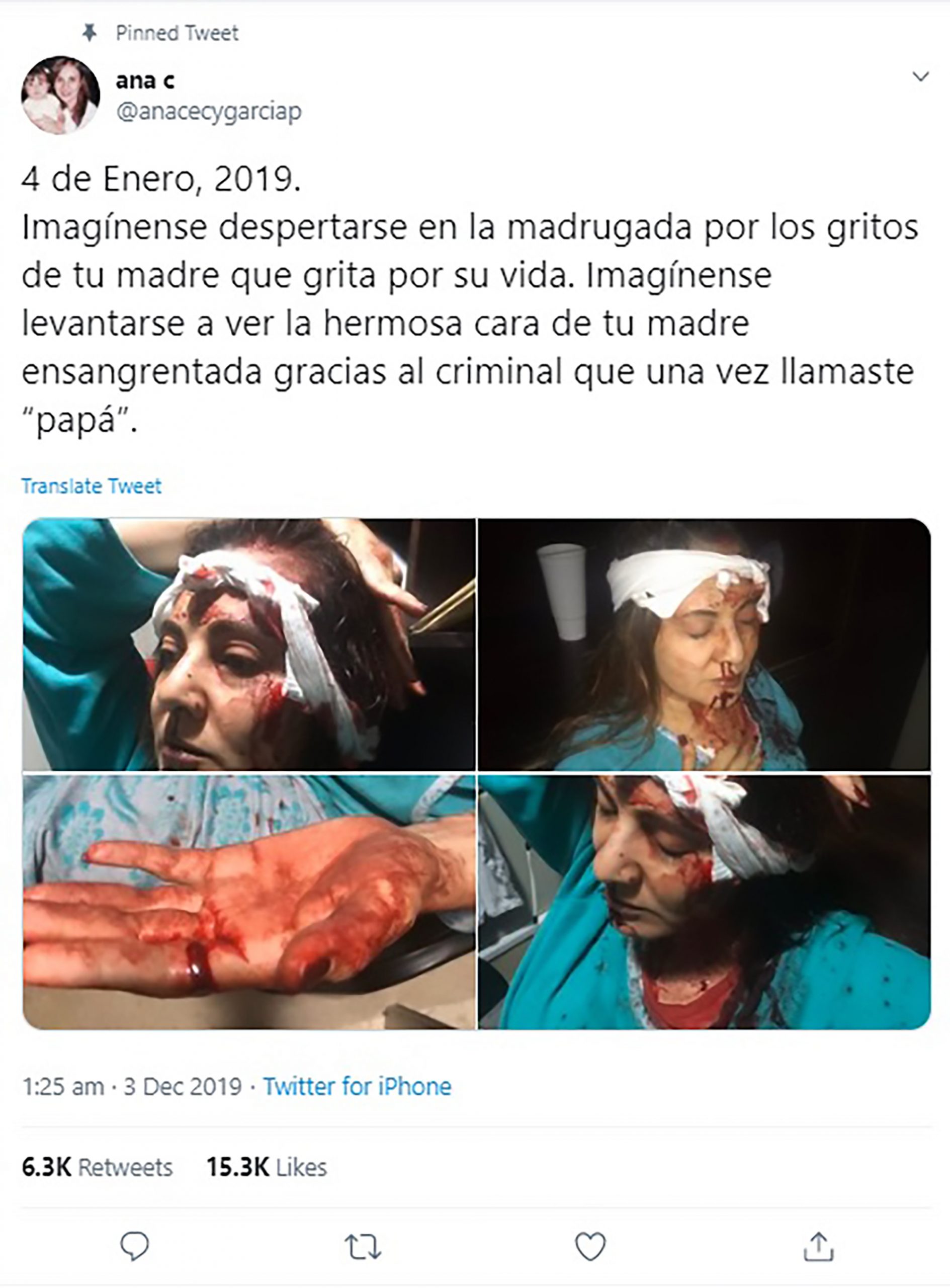 Read more about the article Pictures Of Bleeding Ex-Wife Of Amazon CEO After Attack