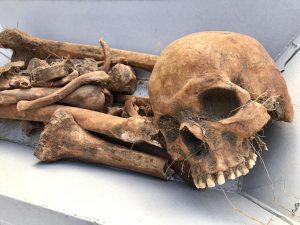 Read more about the article Skull And Skeleton Found By Builders At Posh Restaurant