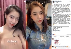 Read more about the article Hot 22yos Family Doesnt Recognise Her After Cosmetic Ops