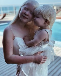 Read more about the article Beautiful Albino Sisters In Kazakhstan Overcome All Odds
