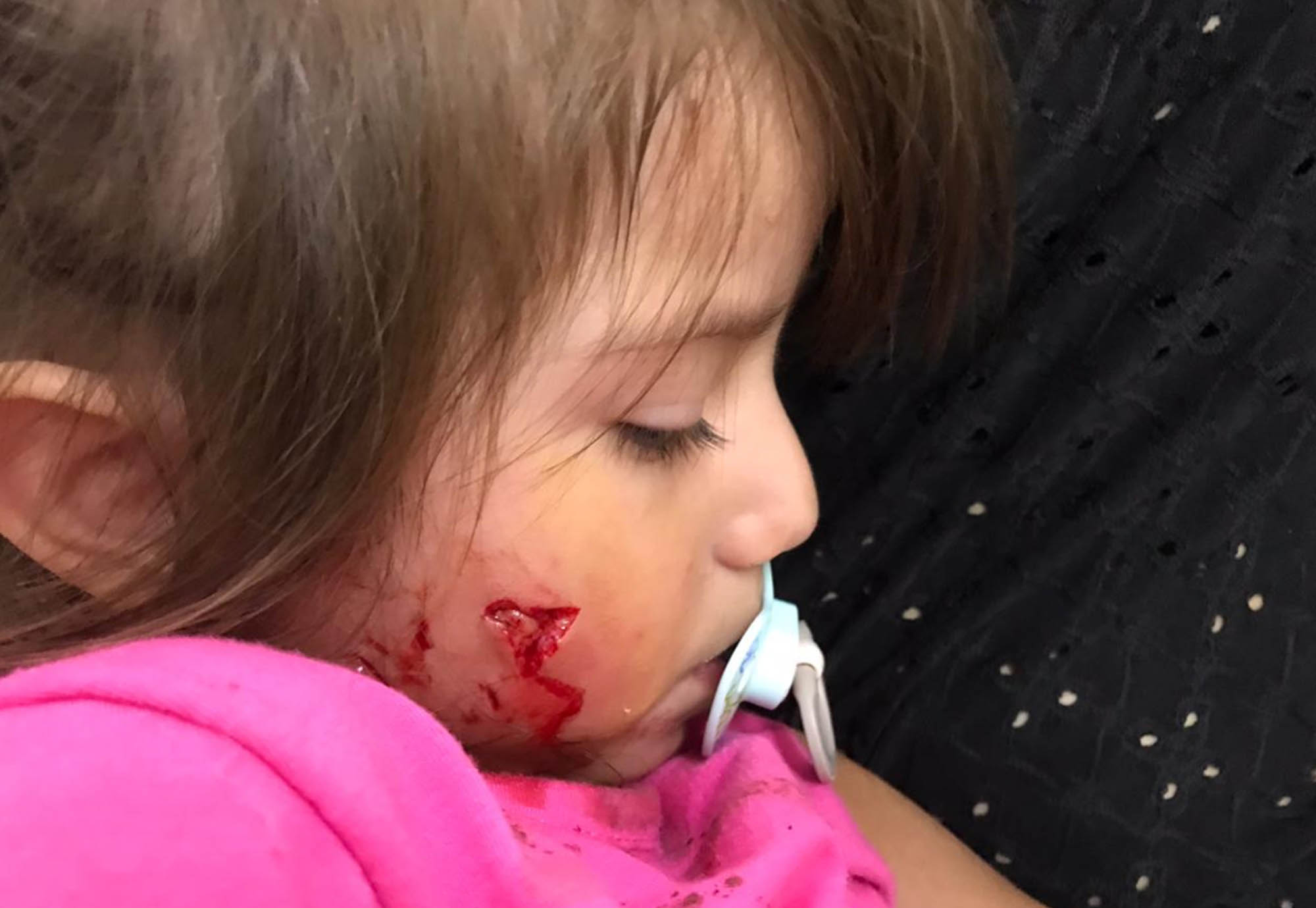 Read more about the article Dog Savages Toddlers Face In Front Of Shocked Mum