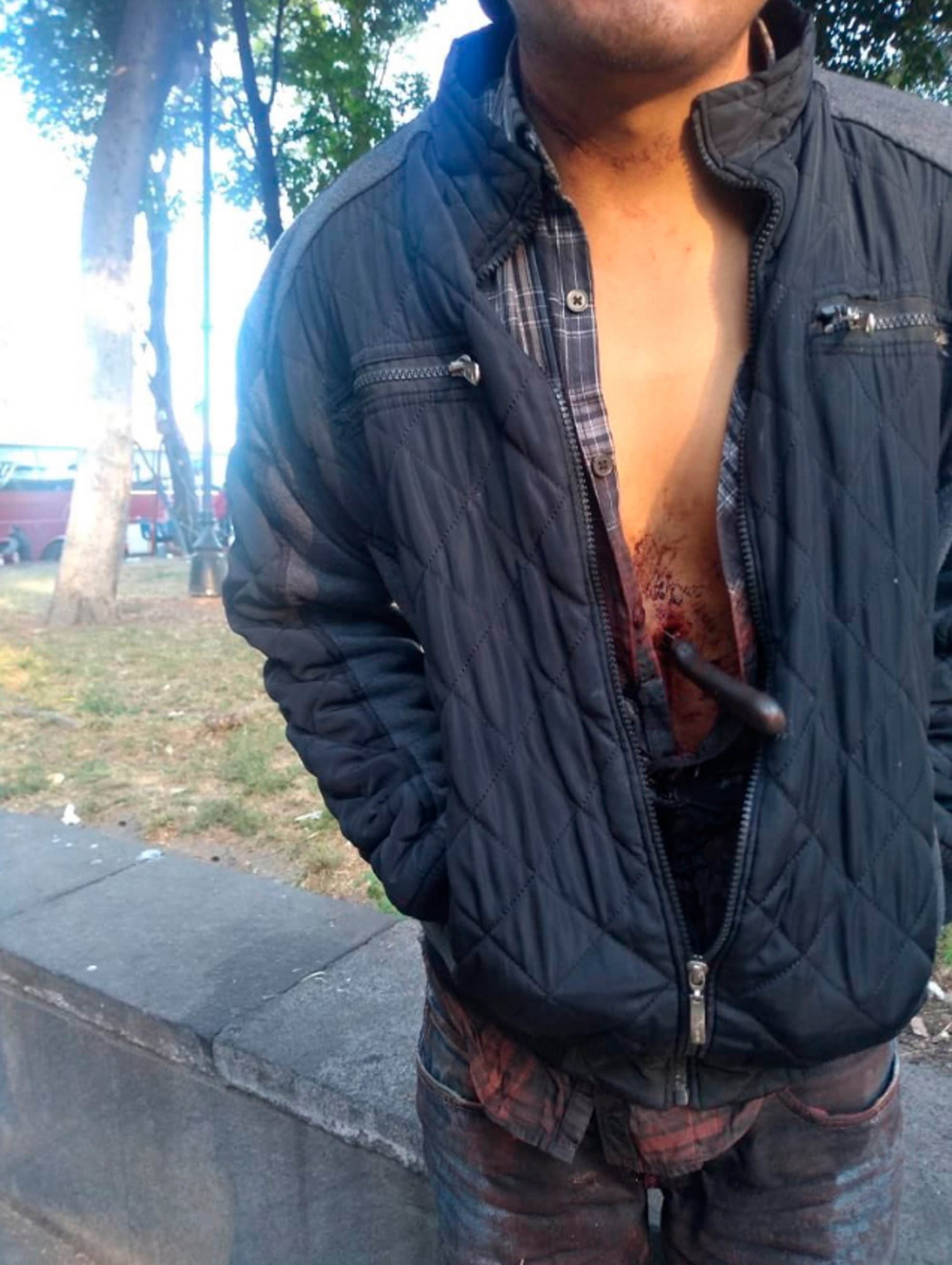 Read more about the article Mexico Man Walks Streets With Knife Stuck In Chest