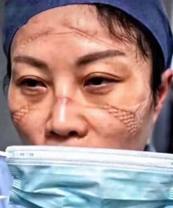 Read more about the article Images Of Drained Wuhan Hospital Staff With Facial Sores