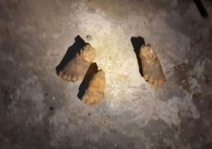 Read more about the article Shocking Pics Show Kids Feet Eaten By Pack Of Dogs