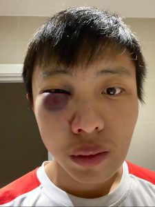 Read more about the article Singapore Student Beaten In London In Coronavirus Attack