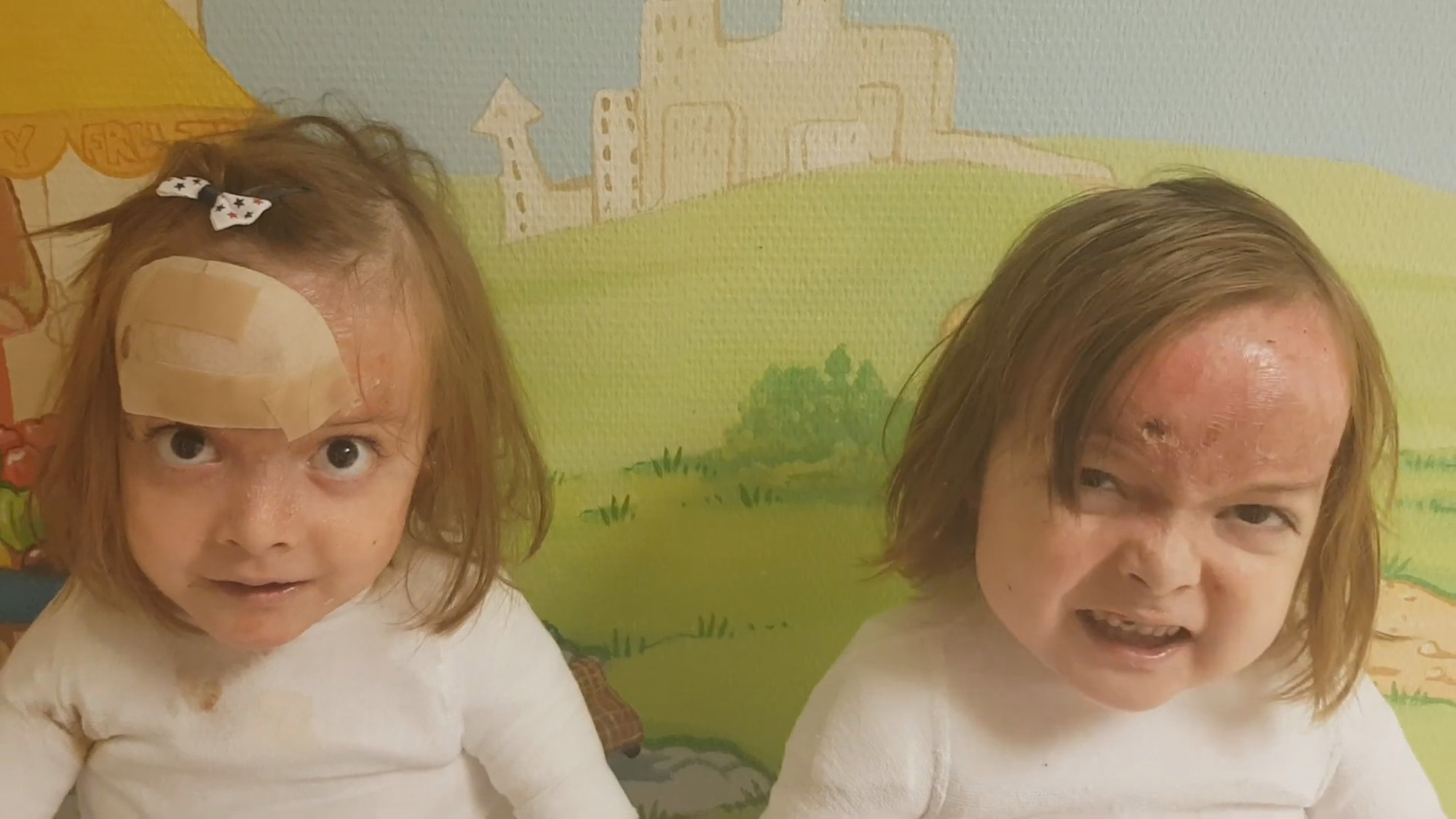 Read more about the article Twins With Rare Disease Tell Others To Stay At Home