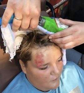 Read more about the article Official Sues Boy She Drove Into For Scratches On SUV