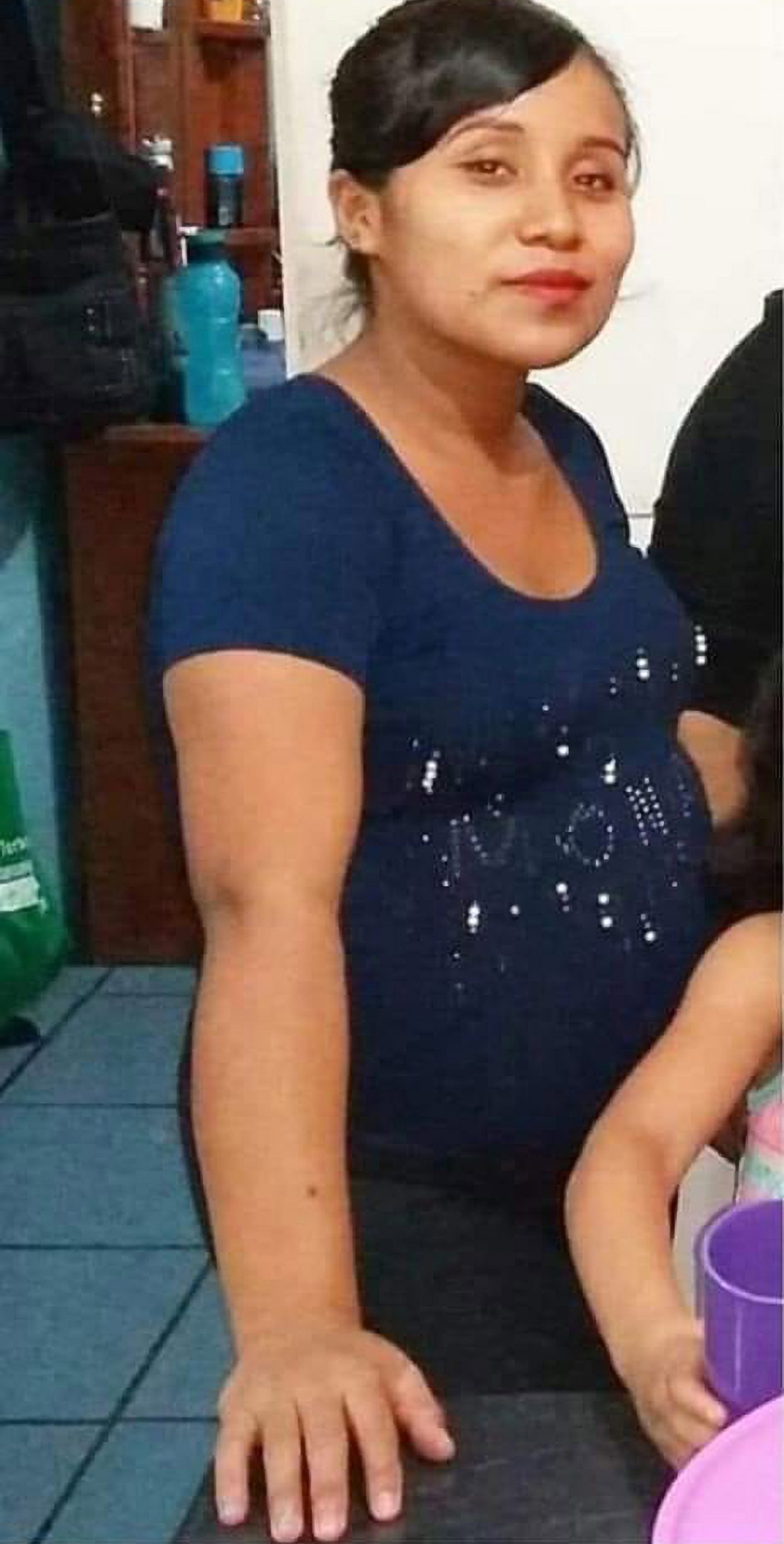 Read more about the article Pregnant Woman Killed After Baby Cut Out At Vet Surgery