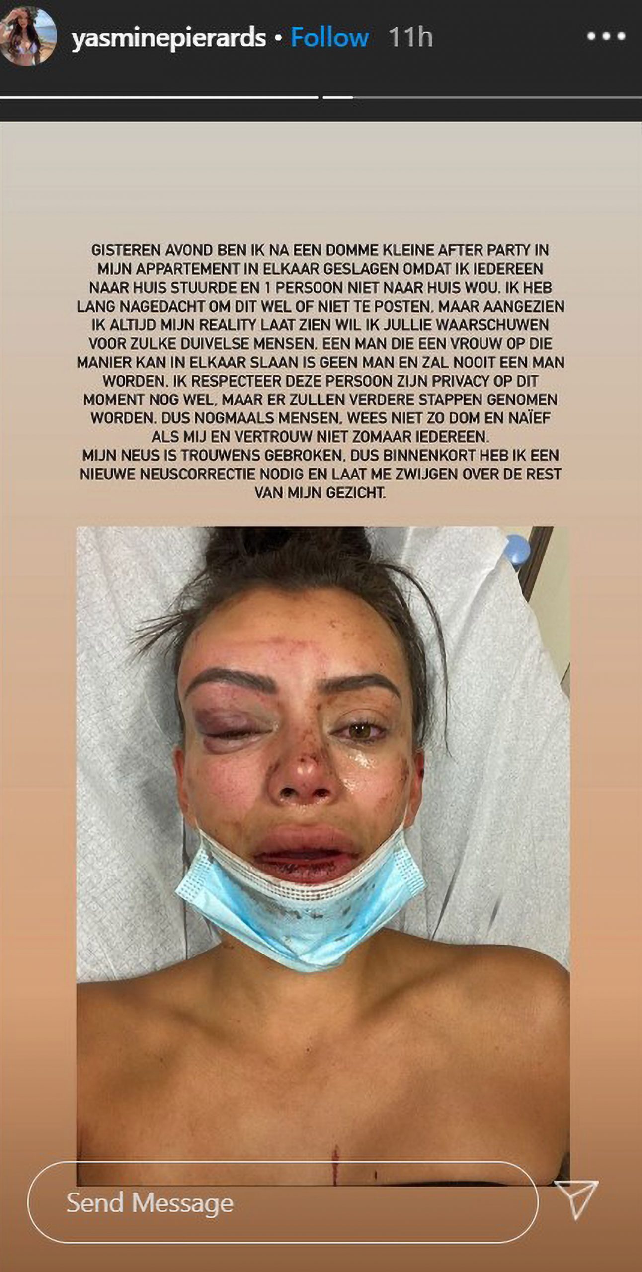Read more about the article Stunning Reality Star Badly Beaten After Home Party