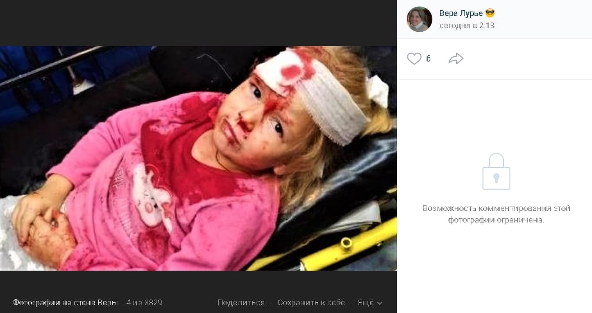 Read more about the article 5yo Girl Injured By Riot Police In Belarus