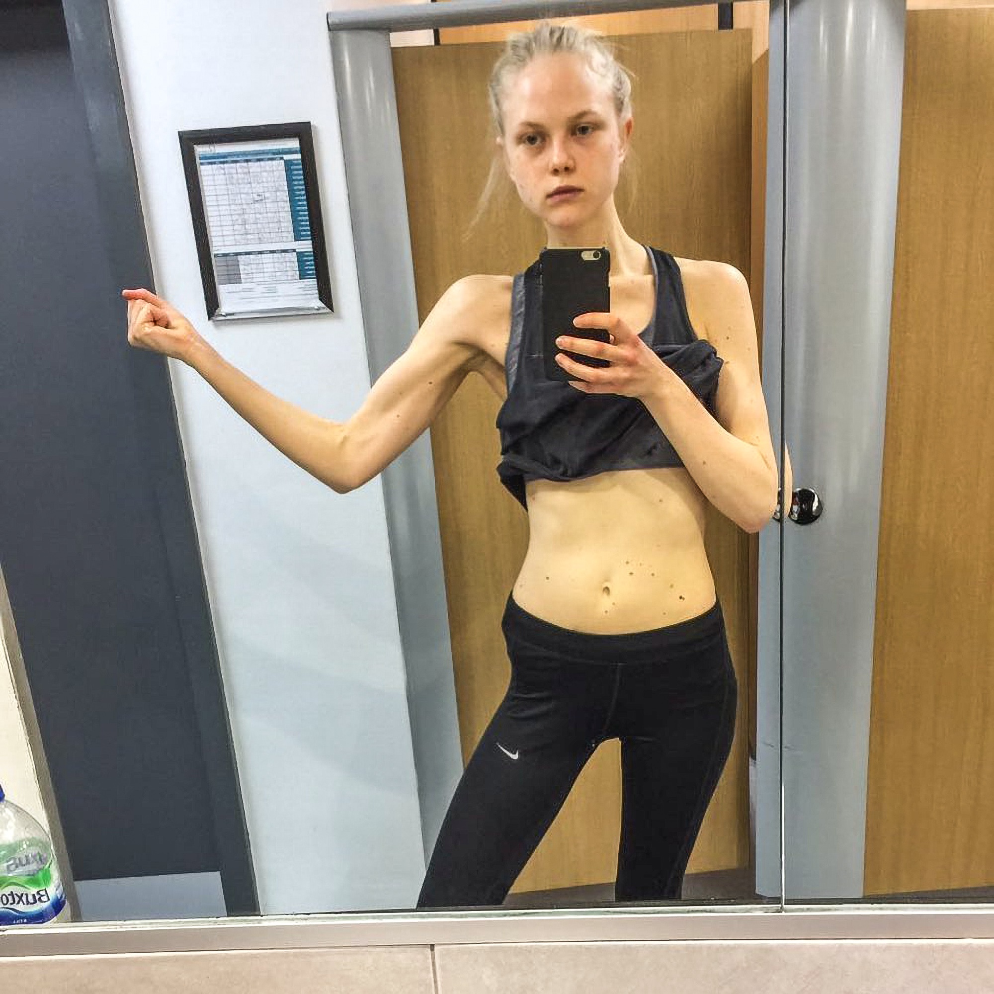 Read more about the article Top Model Reveals How Industry Created Anorexic Drug Hell