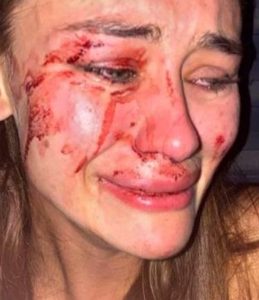 Read more about the article Top Model Drops Complaint Against Bouncers Accused Of Beating Her Bloody
