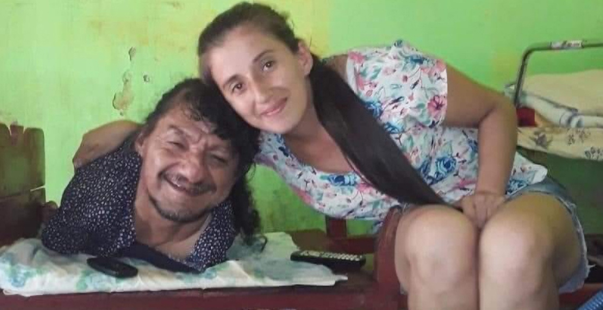 Read more about the article Dad With No Arms And Legs Raised Both Daughters After They Were Abandoned By Mum