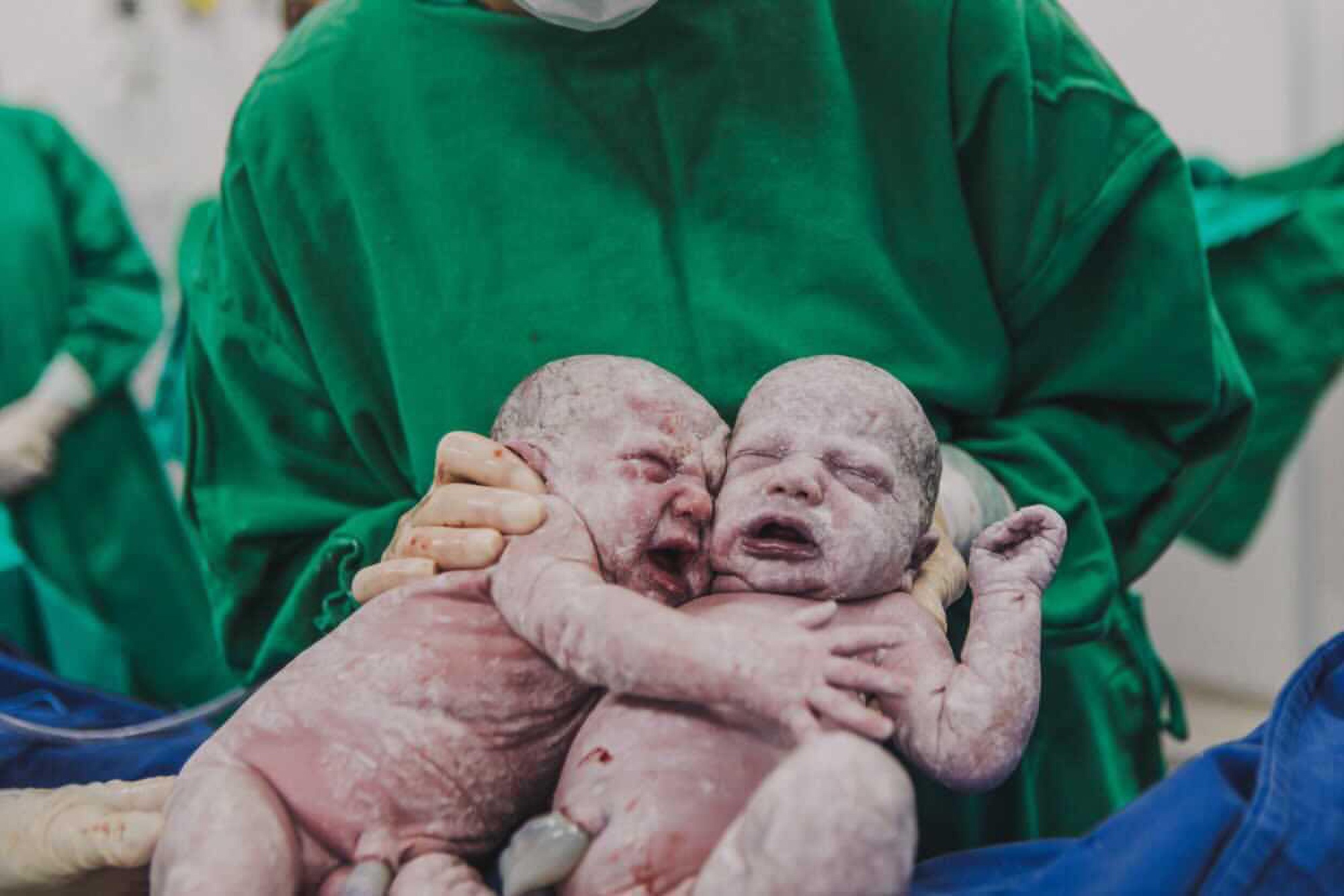 Read more about the article Snap Of Newborn Twin Sisters Hugging In Delivery Room Melts Hearts