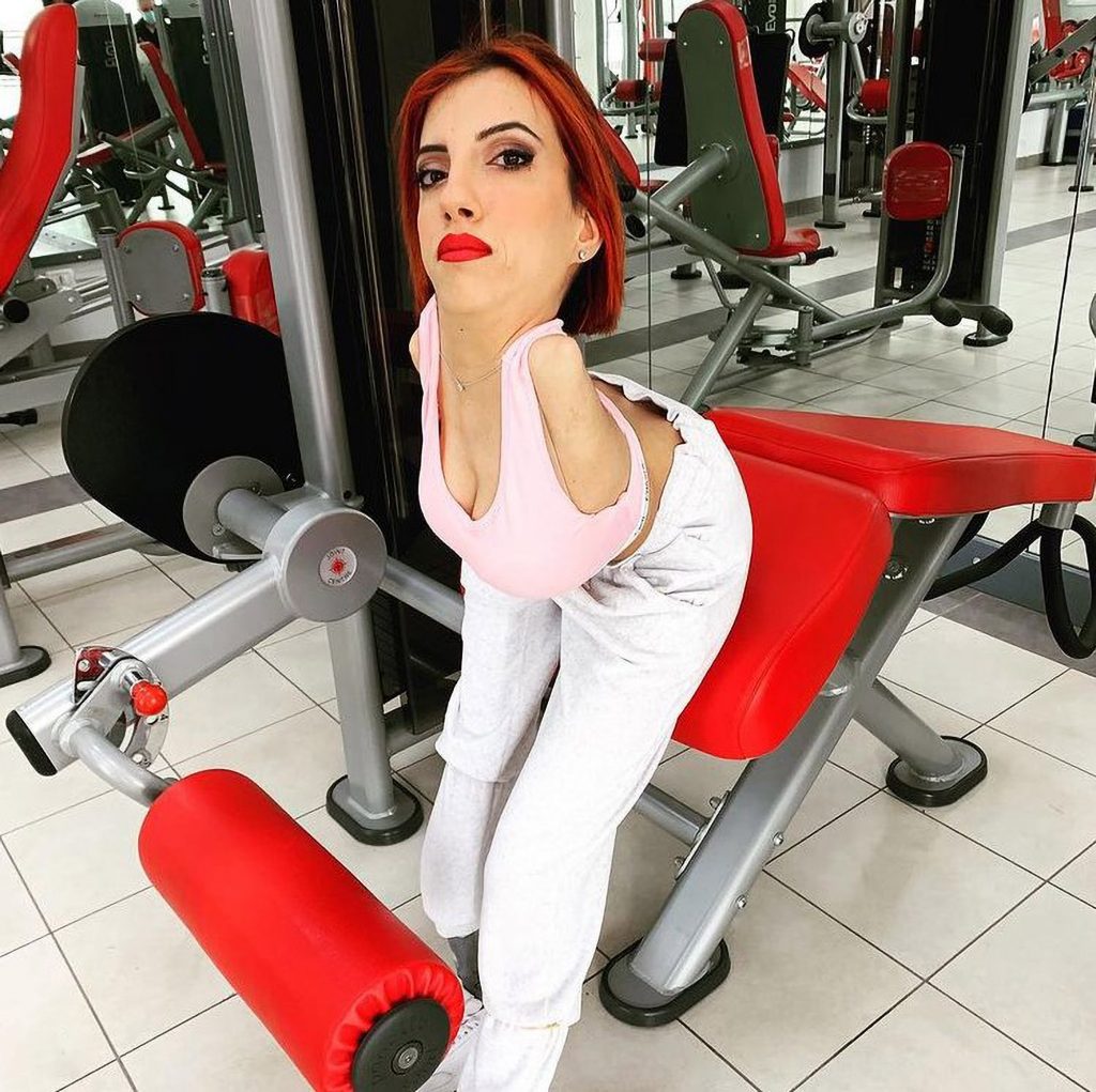 Italian Woman Born Without Arms And A Curved Spine Has Become A Successful Social Media