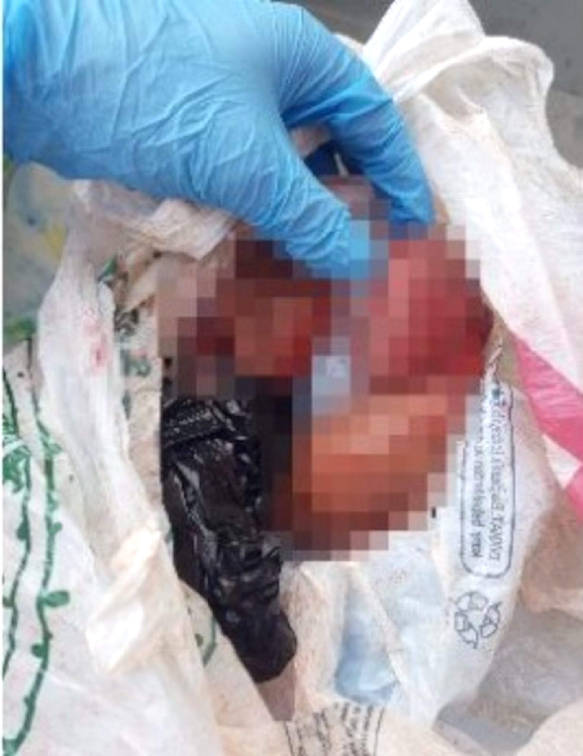 Read more about the article Prostitute Has Miscarriage In Street And Throws Foetus In Bin