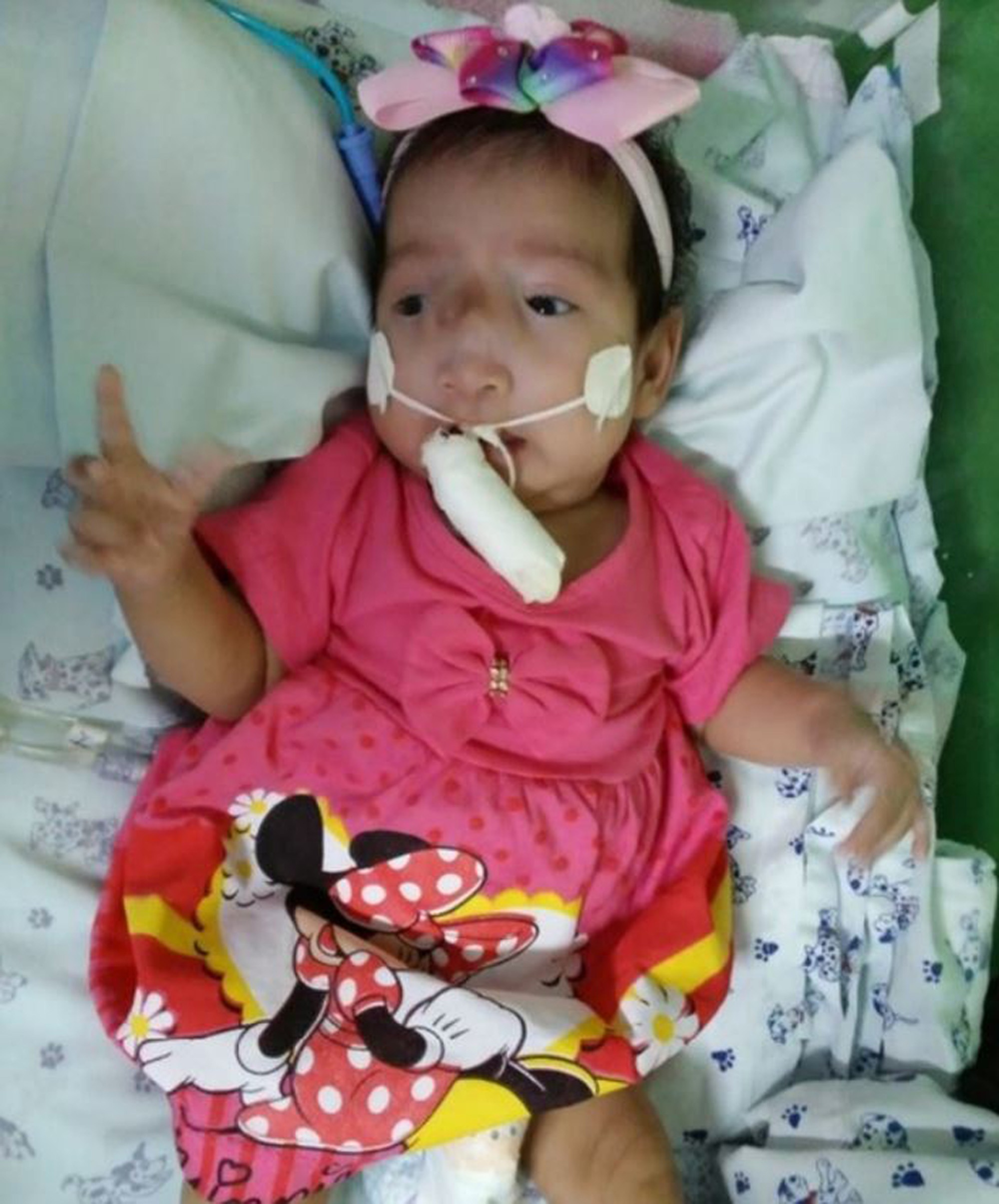 Read more about the article Court Order Saves Disabled Baby Girl From Being Sacrificed By Indigenous Villagers