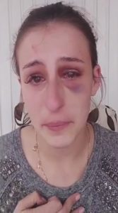 Read more about the article Beautiful Makeup Artist Beaten By Boyfriend Takes To Social Media To Warn Of Domestic Violence