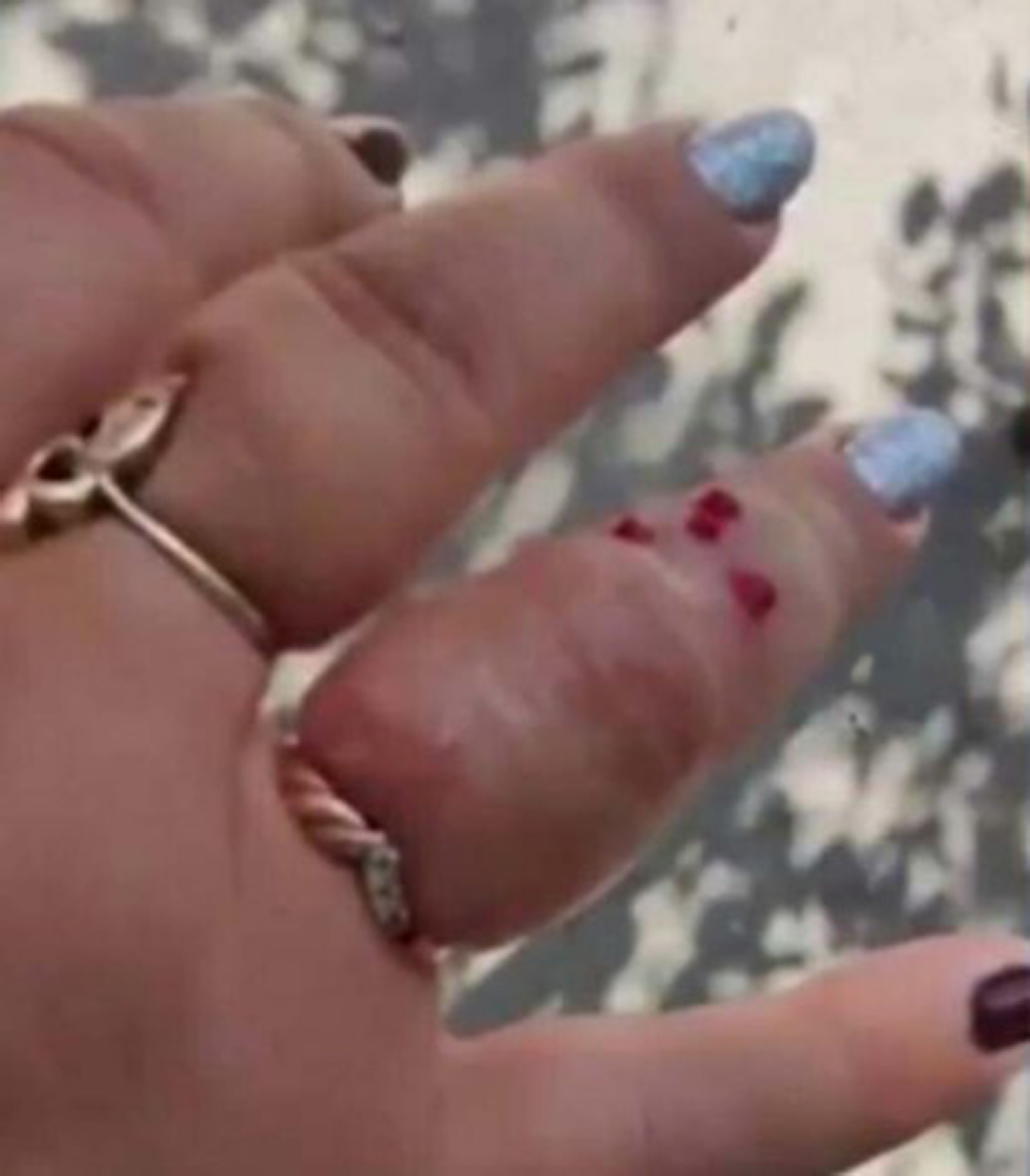 Read more about the article Woman Stung By Wasp Got Help From Police Officer To Remove Ring From Swollen Finger