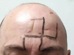 Read more about the article Four Men Wanted For Brutally Attacking Gay Man And Drawing Swastika On His Forehead