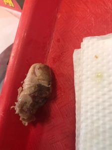 Read more about the article Woman Bites Into Burger And Chews On Grim Remains Of Rotting Human Finger