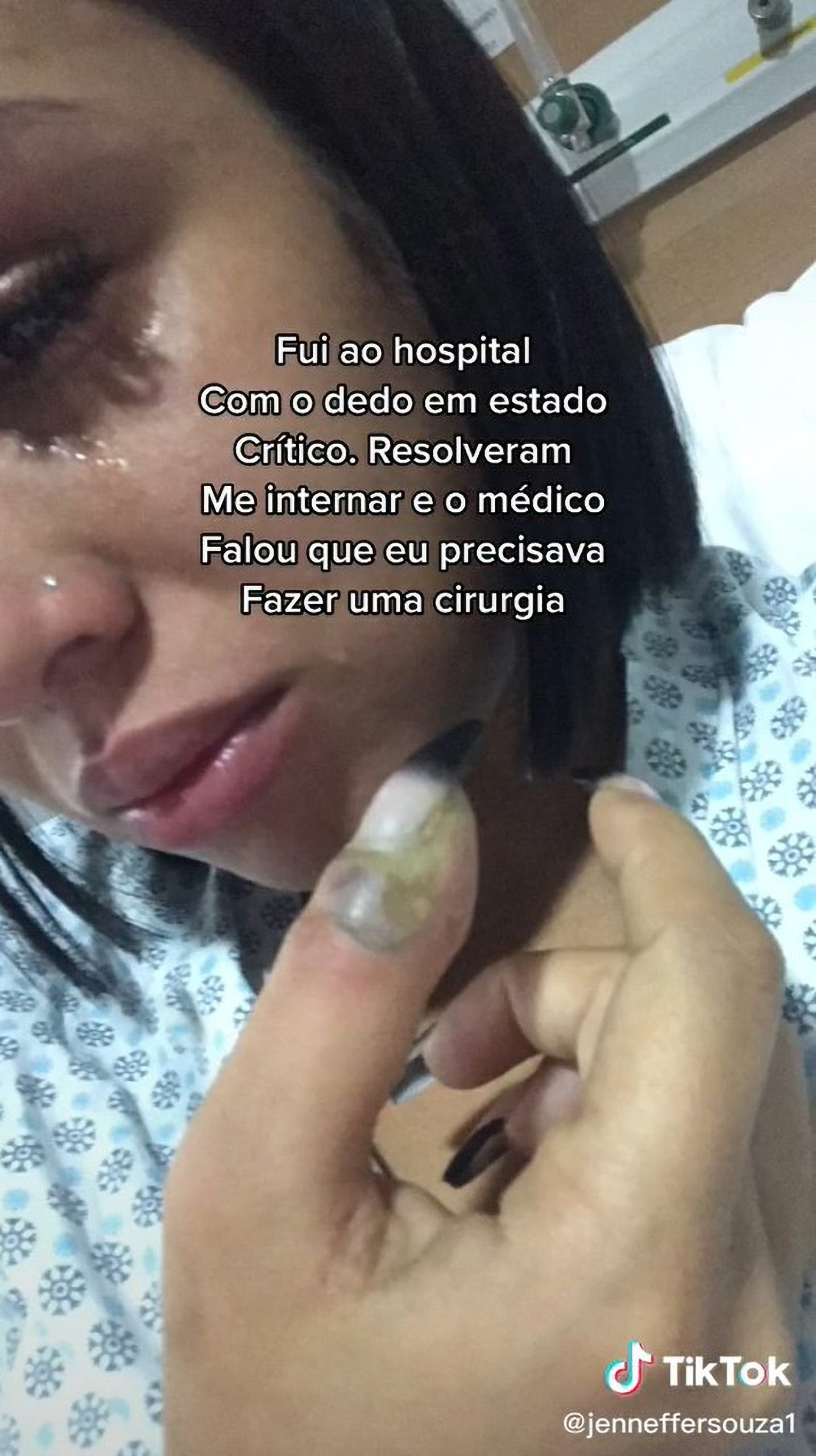 Read more about the article Beautiful Young Woman Has Thumb Partially Amputated After She Covered Up Wound With False Nail
