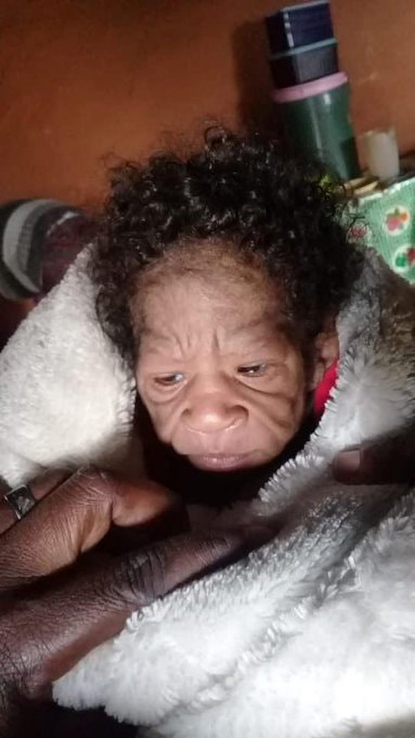 Read more about the article Benjamin Button Baby Who Was Born Looking Older Than Her Mum Due To Rare Condition Dies