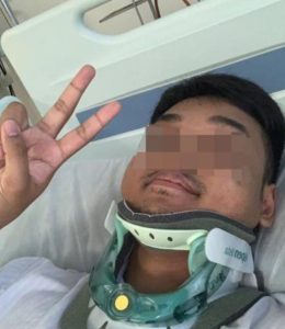 Read more about the article Biker Saved By Apple Smart Watch After Hit And Run Crash In Singapore