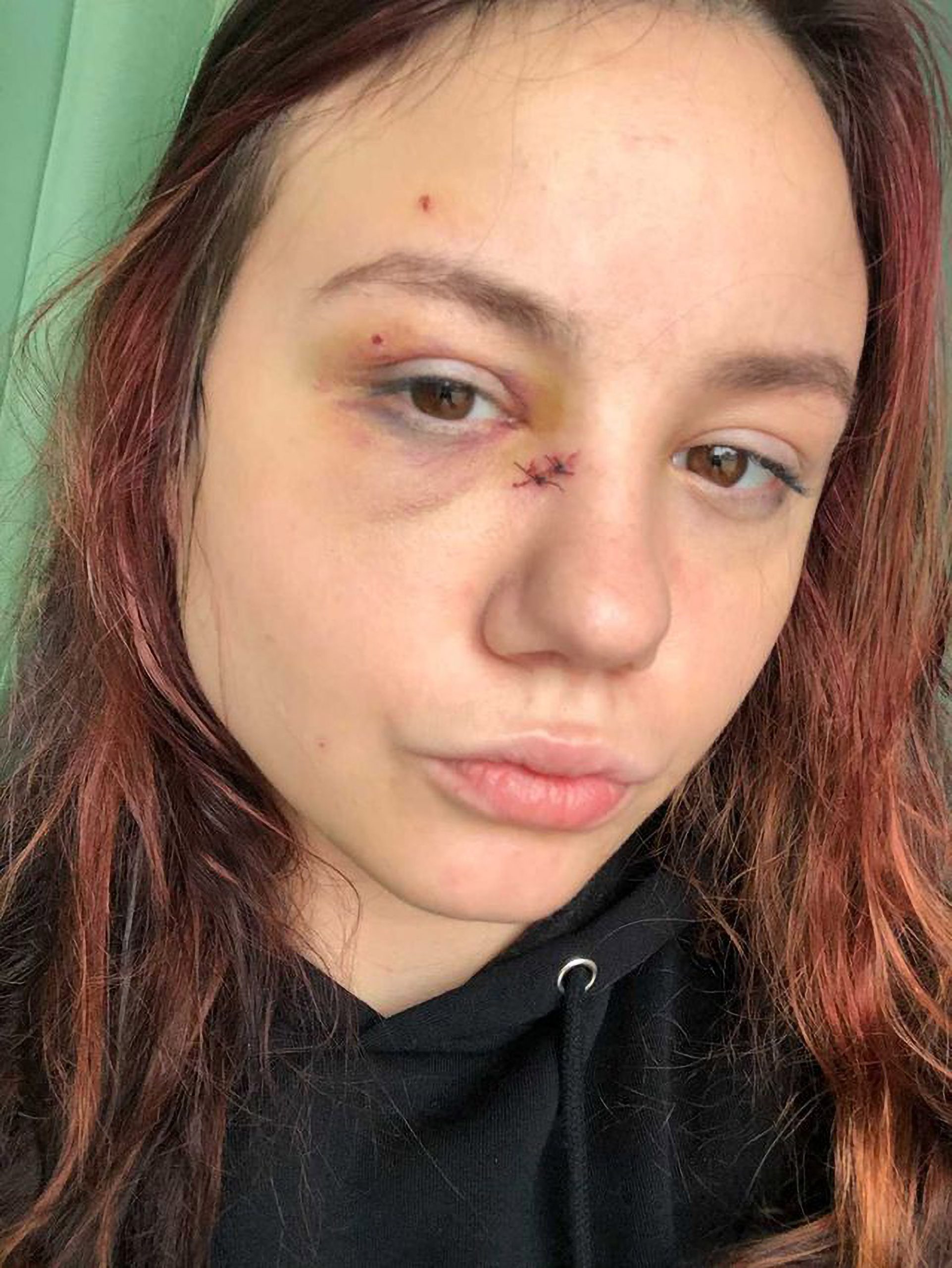 Read more about the article Drunk Neighbour Attacks Influencer With Knife Over Pizza Delivery Row