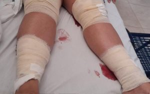 Read more about the article Moment Dangerous Dogs Attack Woman On Street, Leaving Her In Hospital With Bandaged And Bloodied Legs
