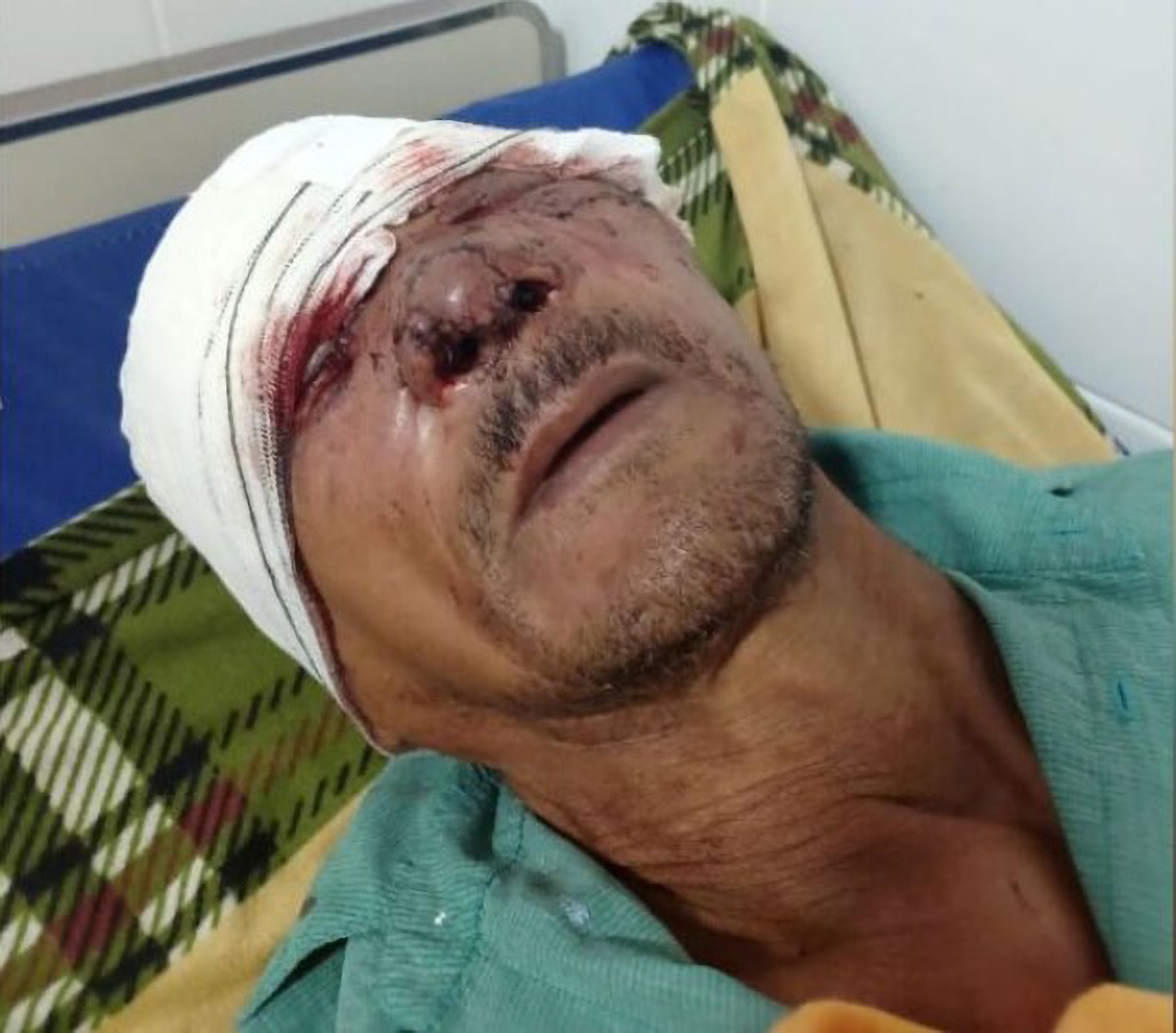 Read more about the article Jaguar Attack Leaves Elderly Man Disfigured And Blind In One Eye